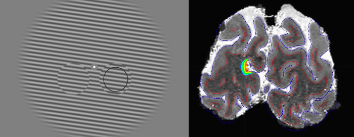 Image showing visual stimulus and high-resolution image of brain region representing that stimulus.